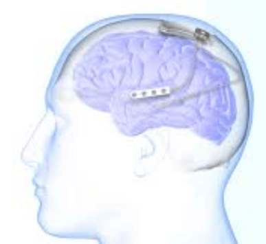 Serivce Image